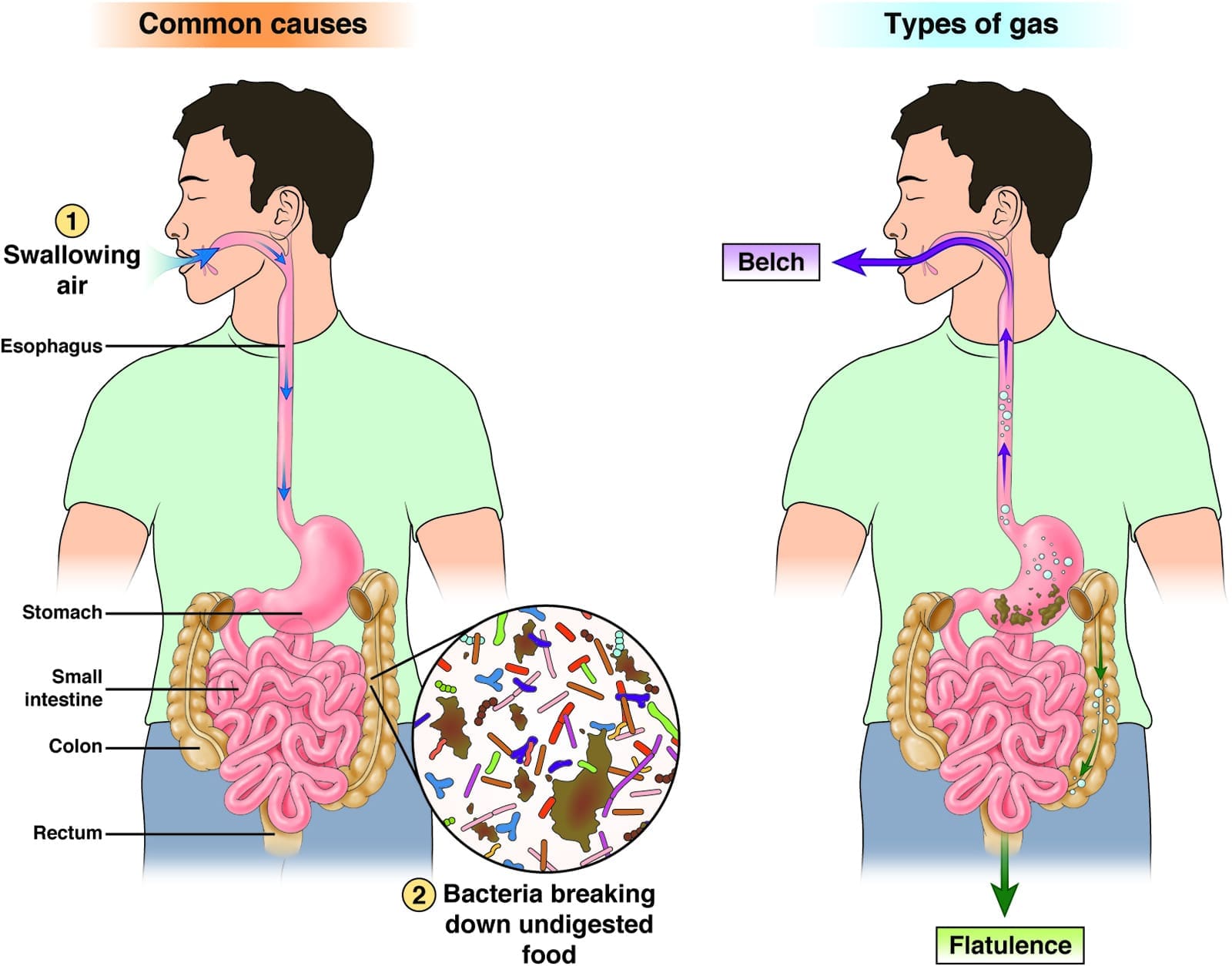 bad bacteria creating gas as it metabolizes